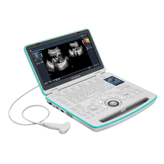 Ultrasonido portatil